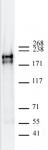 AbFlex<sup>®</sup> DNMT1 antibody (rAb) tested by Western blot.