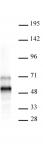 AbFlex<sup>&reg;</sup> MEIS 1/2/3 antibody (rAb) tested by Western blot.