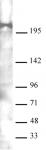 AbFlex<sup>&reg;</sup> Mi-2 beta (CHD4) antibody (rAb) tested by Western blot.