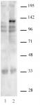 AbFlex<sup>&reg;</sup> SaCas9 antibody (rAb) tested by Western blot.