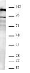 AbFlex<sup>&reg;</sup> JMJD2B / KDM4B antibody (rAb) tested by Western blot.