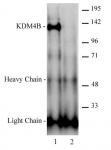 AbFlex<sup>&reg;</sup> JMJD2B / KDM4B antibody (rAb) tested by immunoprecipitation.