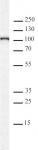 AbFlex<sup>&reg;</sup> KDM1B / LSD2 antibody (rAb) tested by Western blot.