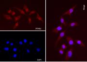 AbFlex<sup>®</sup> PPARγ antibody (rAb) tested by immunofluorescence.