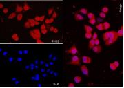 AbFlex<sup>®</sup> PHD2 (EGLN1) antibody (rAb) tested by immunofluorescence.