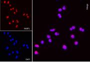 AbFlex<sup>®</sup> PARP1 antibody (rAb) tested by immunofluorescence.