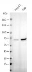 AbFlex<sup>®</sup> METTL3 antibody (rAb) tested by Western blot.