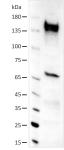 AbFlex<sup>®</sup> GLI1 antibody (rAb) tested by Western blot.