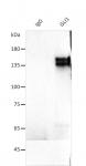 AbFlex<sup>®</sup> GLI1 antibody (rAb) tested by immunoprecipitation.