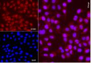 AbFlex<sup>®</sup> SF3B1 antibody (rAb) tested by immunofluorescence.