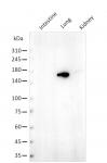 AbFlex<sup>&reg;</sup> SF3B1 antibody (rAb) tested by Western blot.