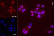 AbFlex<sup>®</sup> TP53BP1 antibody (rAb) tested by immunofluorescence.