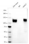 AbFlex<sup>®</sup> HDAC7 antibody (rAb) tested by immunoprecipitation.