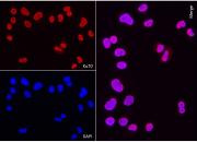 AbFlex<sup>®</sup> XRCC6 (Ku70) antibody (rAb) tested by immunofluorescence.
