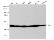 CBX1 antibody (rAb), 100 µl tested by Western blot.