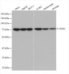 DDX3 antibody (rAb), 100 µg tested by Western blot.