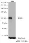GADD34 antibody (rAb), 100 µl tested by Western blot.