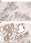 NR3C1 antibody (rAb), 100 µg tested by immunohistochemistry.