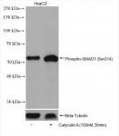 SMAD1 phospho Ser214 (rAb), 100 µl tested by ChIP-chip.