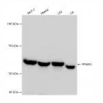 PPAR&gamma; antibody (rAb), 100 µg tested by Western blot.