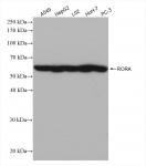 RORA antibody (rAb), 100 µl tested by Western blot.