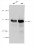 TRPS1 antibody (rAb), 100 µg tested by Western blot.