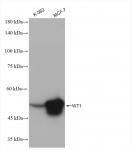 WT1 antibody (rAb), 100 µl tested by Western blot.