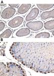 WT1 antibody (rAb), 100 µl tested by immunohistochemistry.